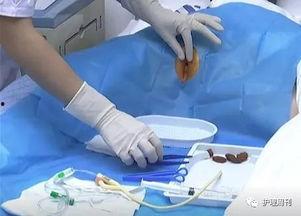 男患者导尿视频,男性导尿操作过程详解
